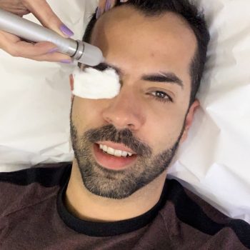 Peeling de Cristal é um super aliado na produção de colágeno e renovação da pele facial