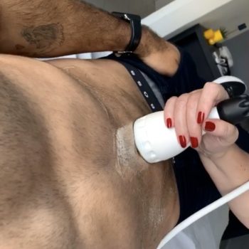 Estética para homens: Vamos falar sobre lipocavitação?